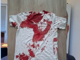 Brutaler Angriff auf AfD-Landtagsabgeordneten: Staatsschutz ermittelt in Rostock