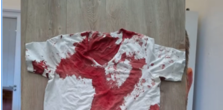 Brutaler Angriff auf AfD-Landtagsabgeordneten: Staatsschutz ermittelt in Rostock