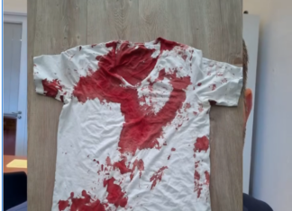 Brutaler Angriff auf AfD-Landtagsabgeordneten: Staatsschutz ermittelt in Rostock