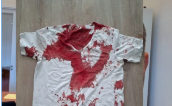 Brutaler Angriff auf AfD-Landtagsabgeordneten: Staatsschutz ermittelt in Rostock