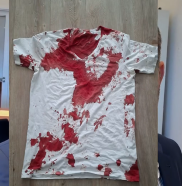 Brutaler Angriff auf AfD-Landtagsabgeordneten: Staatsschutz ermittelt in Rostock