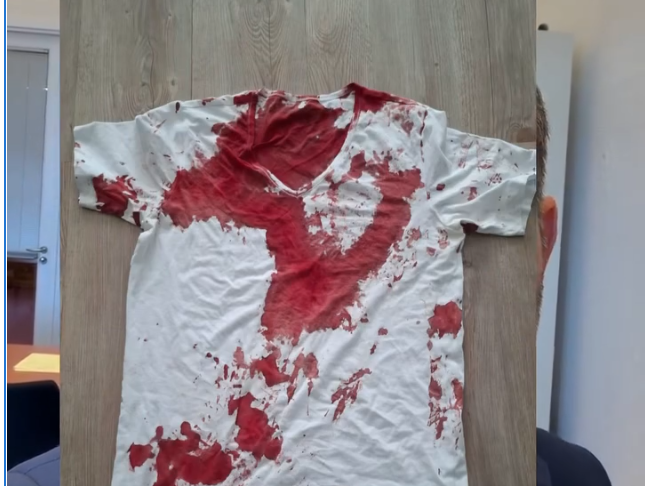 Brutaler Angriff auf AfD-Landtagsabgeordneten: Staatsschutz ermittelt in Rostock