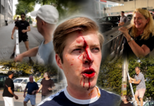 Gewalt gegen die AfD eskaliert: Drei Übergriffe an einem Wochenende